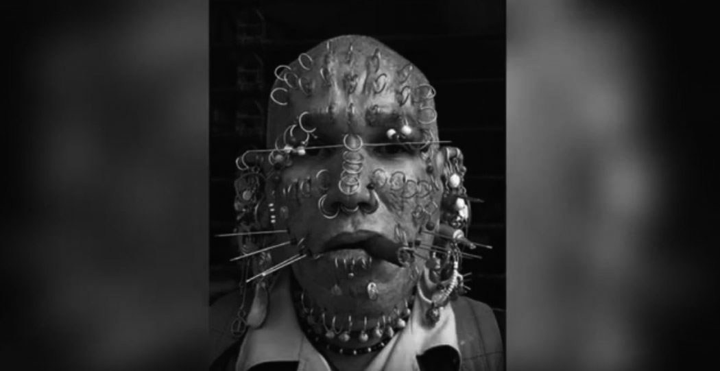 به‌وێنه‌.. مه‌ترسيدارترين نه‌شته‌رگه‌رييه‌كان له‌ جيهاندا ببينه‌